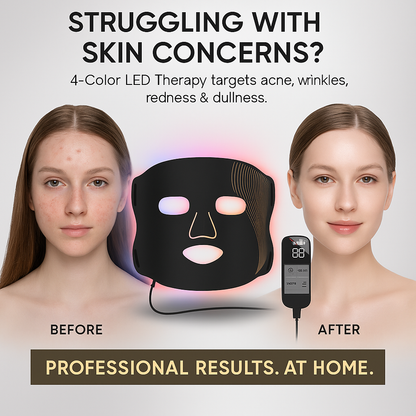 LED Red Light Facial Mask – 4 Spectrum Silicone PDT Therapy | Skin Rejuvenation, Anti-Aging, Wrinkle Removal & Acne Treatment